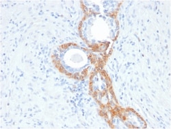 Biotium&nbsp;Cytokeratin, Basic (Type II or HMW)(rKRTH/2148), 0.2mg/mL