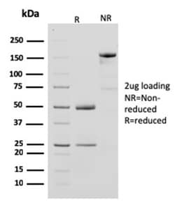 Biotium&nbsp;Creatine Phosphokinase-BB (CK-BB)(CPTC-CKB-2), 0.2mg/mL