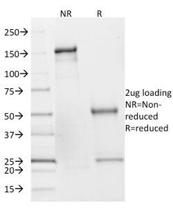 Biotium&nbsp;SDHB (Succinate Dehydrogenase B) (Pheochromocytoma Marker)(SDHB/2382), 0.2mg/mL