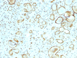 Biotium&nbsp;STAT6 (Solitary Fibrous Tumor Marker)(STAT6/2410), CF647 conjugate, 0.1mg/mL