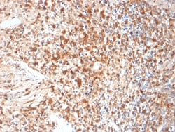 Biotium&nbsp;HSV1 (Herpes Simplex Virus Type I)(HSVI/2095), CF640R conjugate, 0.1mg/mL