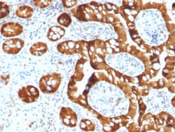 Biotium&nbsp;Sulfotransferase family 1E, estrogen-preferring, member 1(CPTC-SULT1E1-1), CF647 conjugate, 0.1mg/mL