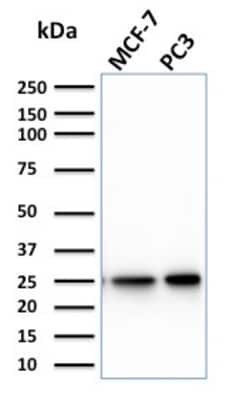 Biotium&nbsp;Calcineurin B homologous protein 2 / HCC Antigen 520(CPTC-CHP2-1), CF647 conjugate, 0.1mg/mL