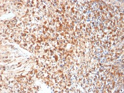 Biotium&nbsp;HSV1 (Herpes Simplex Virus Type I)(HSVI/2095), CF647 conjugate, 0.1mg/mL