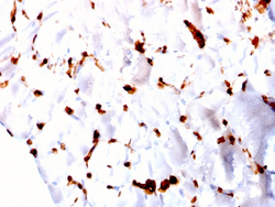 Biotium&nbsp;FABP5 (Marker of Metastatic Potential in Colorectal Cancer)(CPTC-FABP5-3), CF647 conjugate, 0.1mg/mL