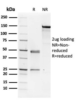 Biotium&nbsp;NME1 / nm23-H1 / NDPK-A (Suppressor of Metastasis)(CPTC-NME1-2), CF647 conjugate, 0.1mg/mL