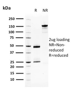 Biotium&nbsp;Squamous Cell Carcinoma Antigen 1(CPTC-SERPINB3-2), CF647 conjugate, 0.1mg/mL