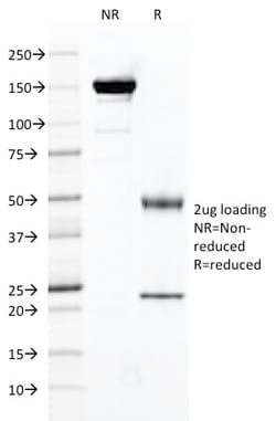 Biotium&nbsp;FOLH1 / PSMA (Prostate Epithelial Marker)(FOLH1/2121), CF640R conjugate, 0.1mg/mL