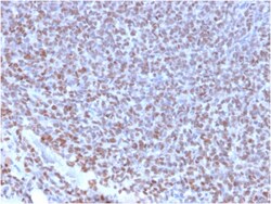 Biotium&nbsp;NKX2.2 (Neuroendocrine & Ewing's Sarcoma Marker)(NX2/2198R), CF647 conjugate, 0.1mg/mL