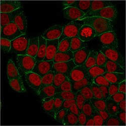 Biotium&nbsp;Catenin, gamma (Cardiomyocyte Marker)(rCTNG/1664), CF640R conjugate, 0.1mg/mL