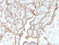 Biotium&nbsp;Annexin A1 / (Hairy Cell Leukemia Marker)(CPTC-ANXA1-1), CF640R conjugate, 0.1mg/mL