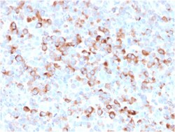 Biotium&nbsp;Tyrosinase (Melanoma Marker)(rOCA1/812), CF647 conjugate, 0.1mg/mL