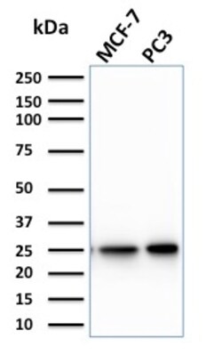 Biotium&nbsp;Calcineurin B homologous protein 2 / HCC Antigen 520(CPTC-CHP2-1), CF640R conjugate, 0.1mg/mL