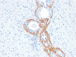 Biotium&nbsp;Cytokeratin, Basic (Type II or HMW)(rKRTH/2148), CF568 conjugate, 0.1mg/mL