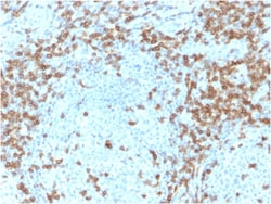 Biotium&nbsp;CD5 (Mantle Cell Lymphoma Marker)(CD5/2418), CF640R conjugate, 0.1mg/mL