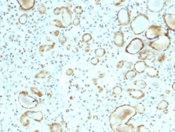 Biotium&nbsp;STAT6 (Solitary Fibrous Tumor Marker)(STAT6/2410), CF405S conjugate, 0.1mg/mL