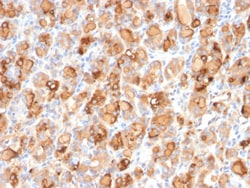 Biotium&nbsp;Thyroglobulin (Thyroidal Cell Marker)(r2H11), CF647 conjugate, 0.1mg/mL