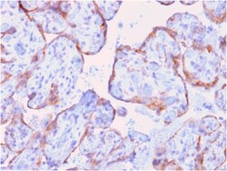 Biotium&nbsp;MMP3 (Marker of Metastasis and Rheumatoid Arthritis)(rMMP3/1730), CF647 conjugate, 0.1mg/mL