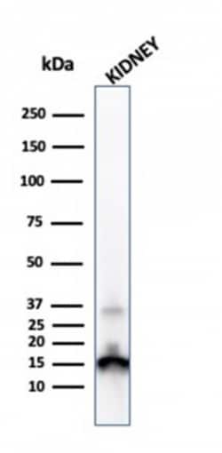 Biotium&nbsp;Transthyretin (Prealbumin)(CPTC-TTR-1), CF640R conjugate, 0.1mg/mL