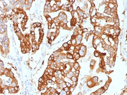 Biotium&nbsp;Cytokeratin 7 (Glandular and Transitional Epithelial Marker)(KRT7/2200), CF647 conjugate, 0.1mg/mL
