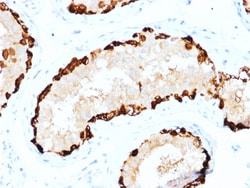 Biotium&nbsp;Melanoma Antigen Family A, 4 / MAGEA4(CPTC-MAGEA4-1), CF640R conjugate, 0.1mg/mL