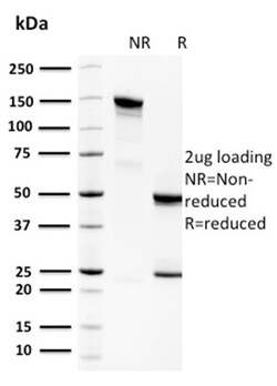Biotium&nbsp;Spermidine or Spermine N1-Acetyltransferase 1(CPTC-SAT1-3), CF640R conjugate, 0.1mg/mL