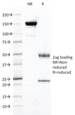 Biotium&nbsp;FOLH1 / PSMA (Prostate Epithelial Marker)(FOLH1/2121), CF568 conjugate, 0.1mg/mL