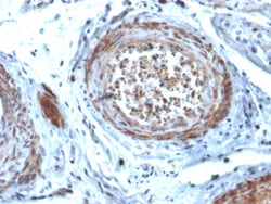 Biotium&nbsp;StAR (Steroidogenic Acute Regulator) (Leydig Cell Marker)(STAR/2077), CF647 conjugate, 0.1mg/mL