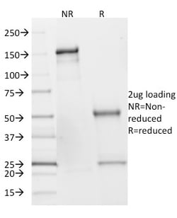 Biotium&nbsp;SDHB (Succinate Dehydrogenase B) (Pheochromocytoma Marker)(SDHB/2382), CF647 conjugate, 0.1mg/mL