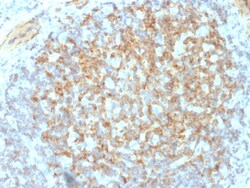 Biotium&nbsp;CD61 / Integrin 3 / Platelet Glycoprotein IIIa (Platelet Marker)(ITGB3/2145), CF640R conjugate, 0.1mg/mL