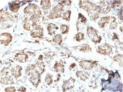Biotium&nbsp;NME2 / nm23-H2 / NDPK-B (Suppressor of Metastasis)(CPTC-NME2-2), Biotin conjugate, 0.1mg/mL
