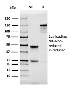 Biotium&nbsp;Calbindin 1 (CALB1)(CALB1/2364), CF594 conjugate, 0.1mg/mL