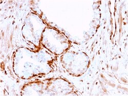 Biotium&nbsp;Aldo-keto Reductase Family 1 Member B1 (Adrenal Marker)(CPTC-AKR1B1-3), CF594 conjugate, 0.1mg/mL