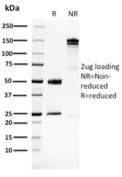 Biotium&nbsp;Glucose 6-Phosphate Isomerase(CPTC-GPI-1), CF594 conjugate, 0.1mg/mL