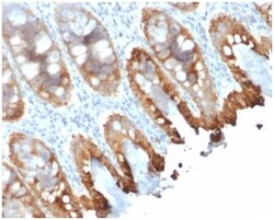 Biotium&nbsp;Cytokeratin 8/18(rKRT8.18/1346), CF594 conjugate, 0.1mg/mL