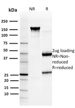 Biotium&nbsp;Glutathione S-Transferase Mu3 (GSTM3)(CPTC-GSTMu3-1), CF488A conjugate, 0.1mg/mL