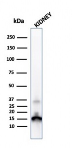 Biotium&nbsp;Transthyretin (Prealbumin)(CPTC-TTR-1), CF594 conjugate, 0.1mg/mL