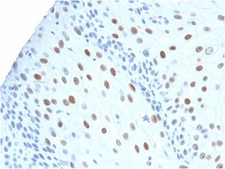 Biotium&nbsp;p21WAF1 (Tumor Suppressor Protein)(CIP1/2275R), CF594 conjugate, 0.1mg/mL