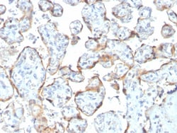 Biotium&nbsp;TIMP2 (Tissue Inhibitor of Metalloproteinase 2)(rTIMP2/2335), CF594 conjugate, 0.1mg/mL