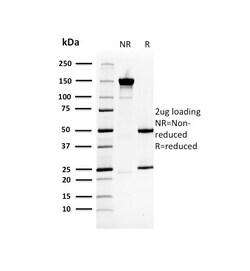 Biotium&nbsp;Heat Shock 27kDa Protein 1 (HPS27)(CPTC-HSPB1-2), Biotin conjugate, 0.1mg/mL