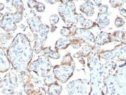Biotium&nbsp;TIMP2 (Tissue Inhibitor of Metalloproteinase 2)(rTIMP2/2335), Biotin conjugate, 0.1mg/mL