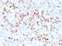 Biotium&nbsp;Tyrosinase (Melanoma Marker)(rOCA1/812), 0.2mg/mL