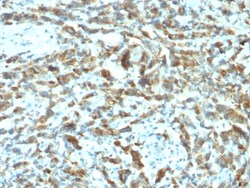 Biotium&nbsp;pS2 / pNR-2 / TFF1 (Estrogen-Regulated Protein)(TFF1/2133), CF740 conjugate, 0.1mg/mL
