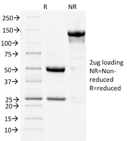 Biotium&nbsp;Cycloxygenase-2 (COX-2)(COX2/1941), CF740 conjugate, 0.1mg/mL