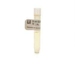 Discovery Life Sciences Lung Cancer Tx Naive PBMC, Quantity: Each of 1