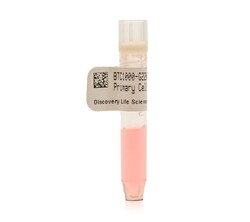Discovery Life Sciences&nbsp;Melanoma DTC