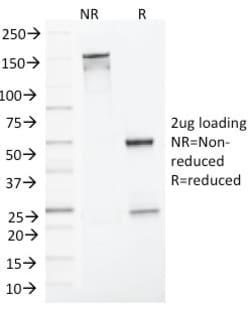 Biotium&nbsp;MLH1 (MutL Homolog 1)(MLH1/1324), CF594 conjugate, 0.1mg/mL