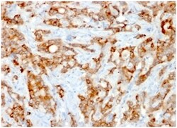 Biotium&nbsp;Beta-2 Microglobulin (Renal Failure &Tumor Marker) (rB2M/961), CF640R conjugate, 0.1mg/mL