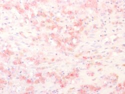 Biotium&nbsp;Tyrosinase-Related Protein-1 (TYRP-1) (Melanoma Marker), CF640R conjugate, 0.1mg/mL