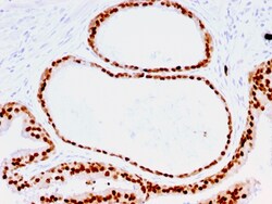 Biotium&nbsp;FOXA1 / HNF3A(FOXA1/1516), CF640R conjugate, 0.1mg/mL